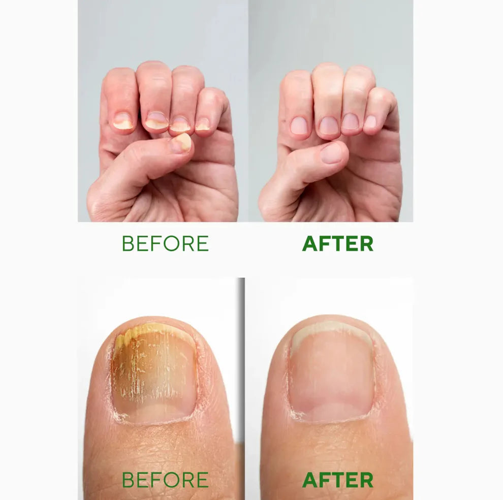 Nail Repair Serum